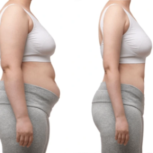 Group logo of Phentermine Online Weight Loss Program: Results After 1 Week